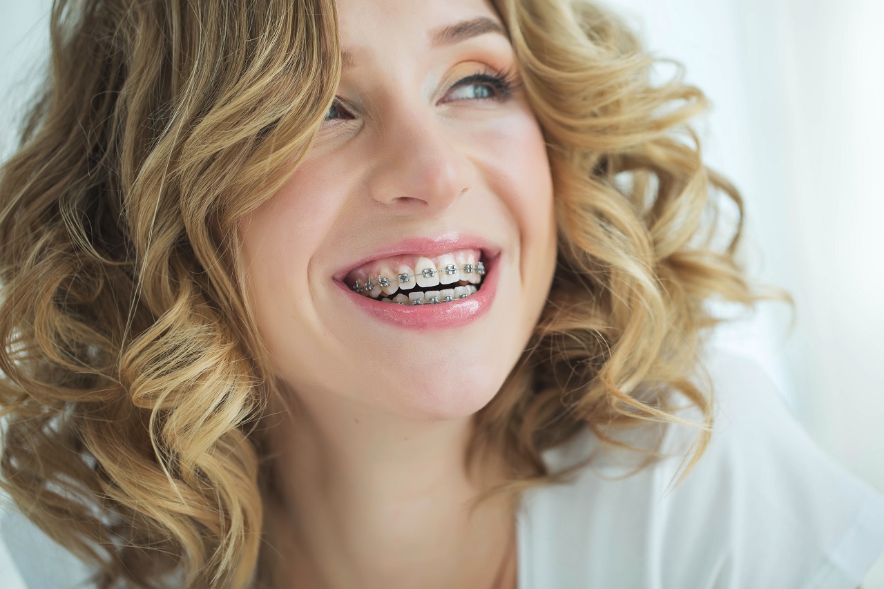 Aparat ortodontyczny – inwestycja w piękny uśmiech